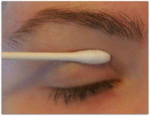 apply qtip drooping eyelid