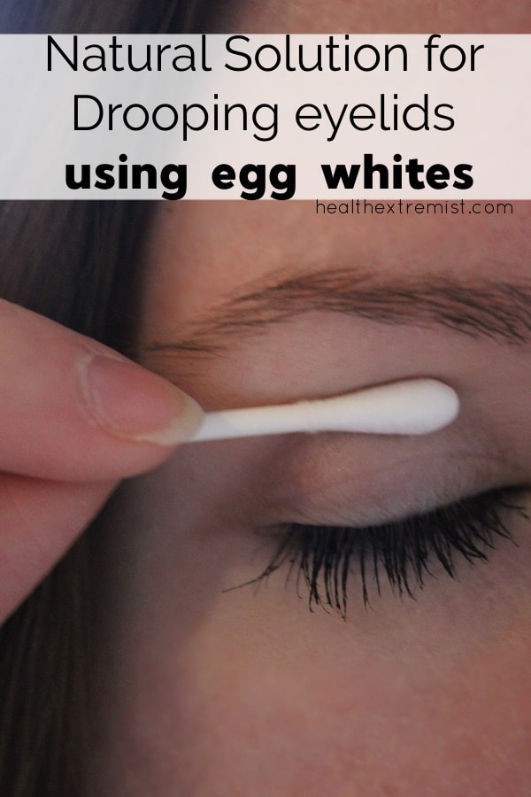 Apply Egg White for Natural Remedy for Drooping Eyelids - The egg white hardens and changes how your eyelid falls.