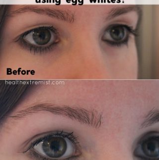 Before and after pictures of a girl's eyes with text overlay - natural remedy for drooping eyelids and hooded eyelids using egg whites