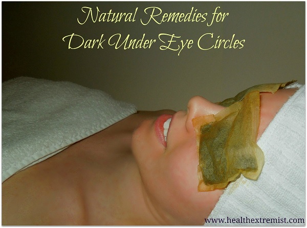 natural remedies for dark under eye circles