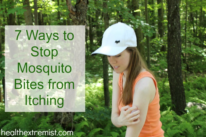 7 Natural Remedies for Mosquito Bites to Instantly Relieve the Itch