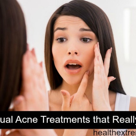 5 Unusual Acne Treatments That Really Work! - These simple methods can help prevent breakouts and blackheads. Using the oil cleansing mehtod and the caveman regimen has really helped clear my skin.