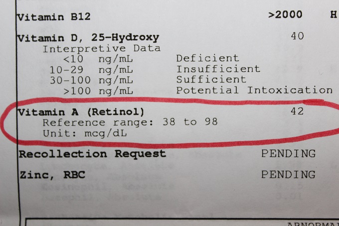 My vitamin A blood test results