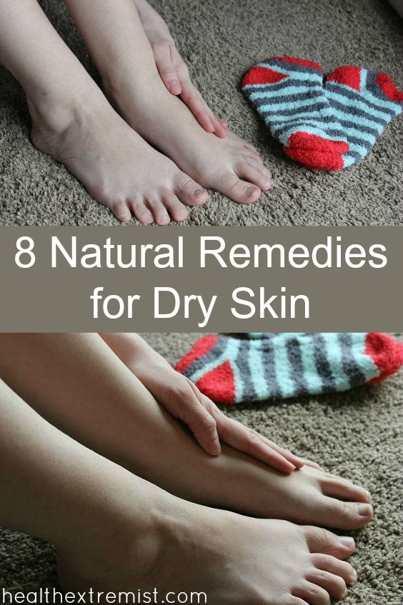 8 Natural Home Remedies for Dry Skin - Quick ways to help dry skin for your face and body. Great for acne prone skin too!