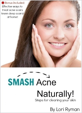 Acne-ebook-cover