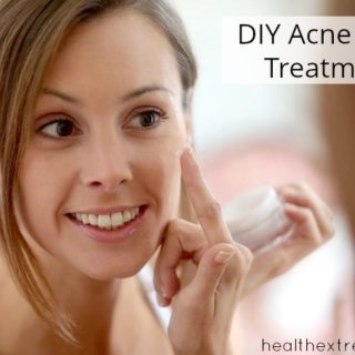 Natural DIY Acne Spot Treatment - apply to breakouts to help reduce size and redness.