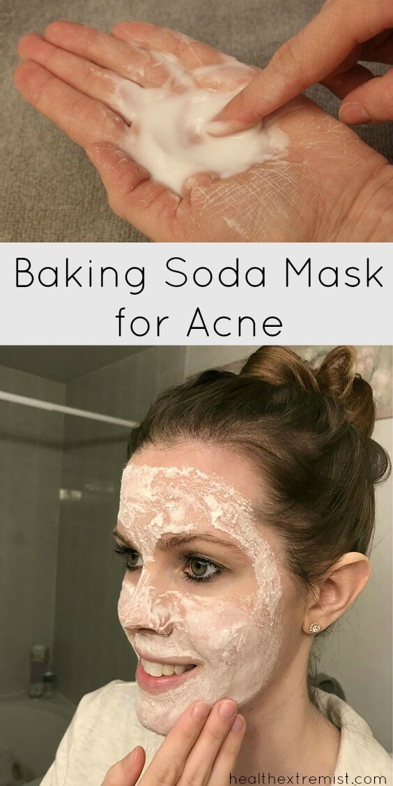 Make a Baking Soda Face Mask for Acne Prone Skin - This mask helps prevent breakouts and fights acne. It also exfoliates your skin and removes dead skin cells that can clog pores.