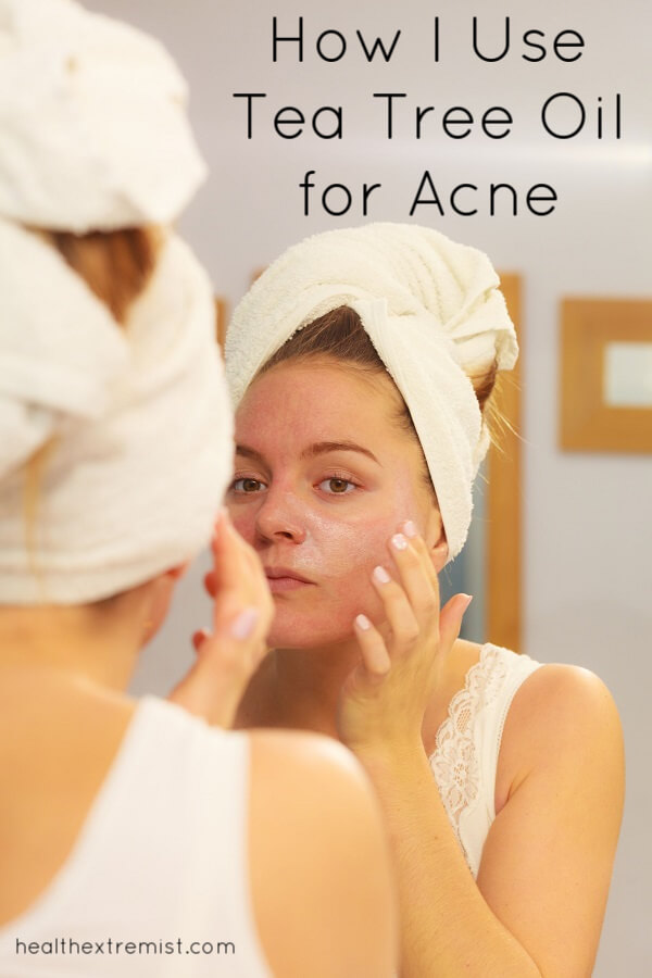 How to Use Tea Tree Oil for Acne to treat breaouts and prevent new breakouts